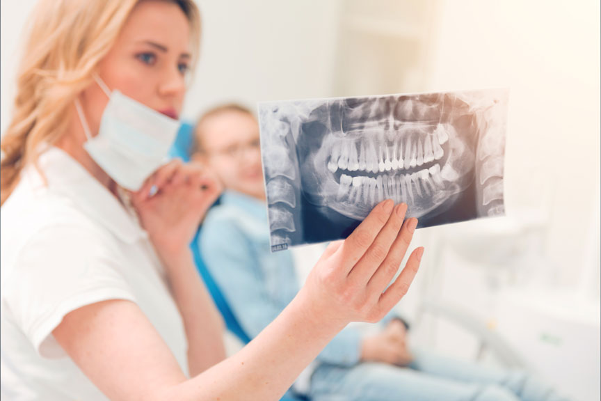 Does Everyone Need Wisdom Tooth Extraction?
